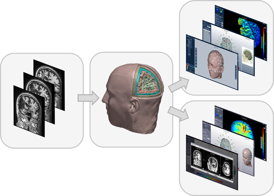 Soterix Medical Individualized Modeling Service